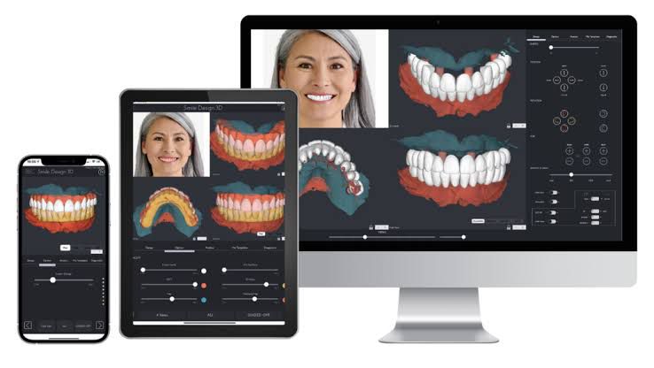 DIGITAL SMILE MAKEOVER SYSTEM